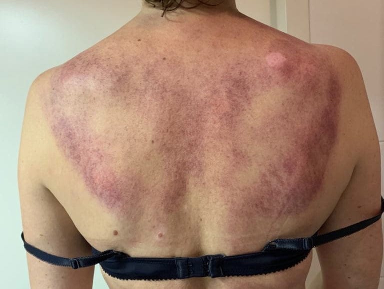 Bellabaci Benelux - Cupping