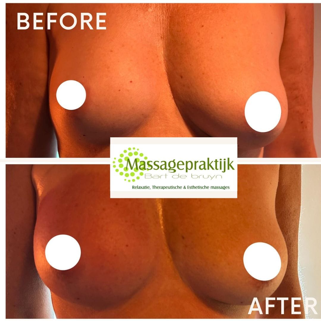 wellnesscupping vacuumbodydrainer