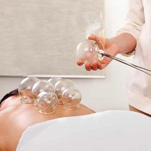 Stalen klem t.b.v. vuurcupping 25cm - Afbeelding 2