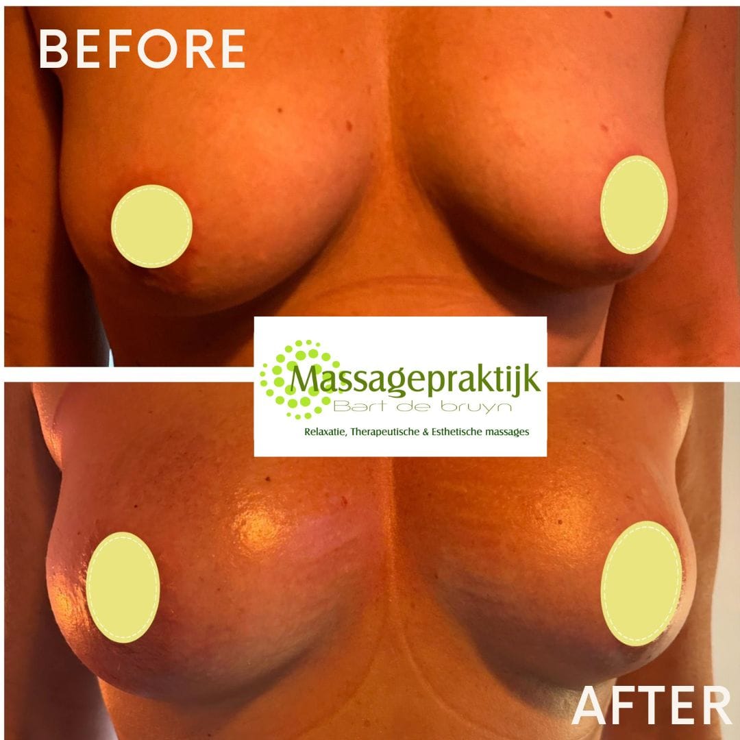 wellnesscupping vacuumbodydrainer