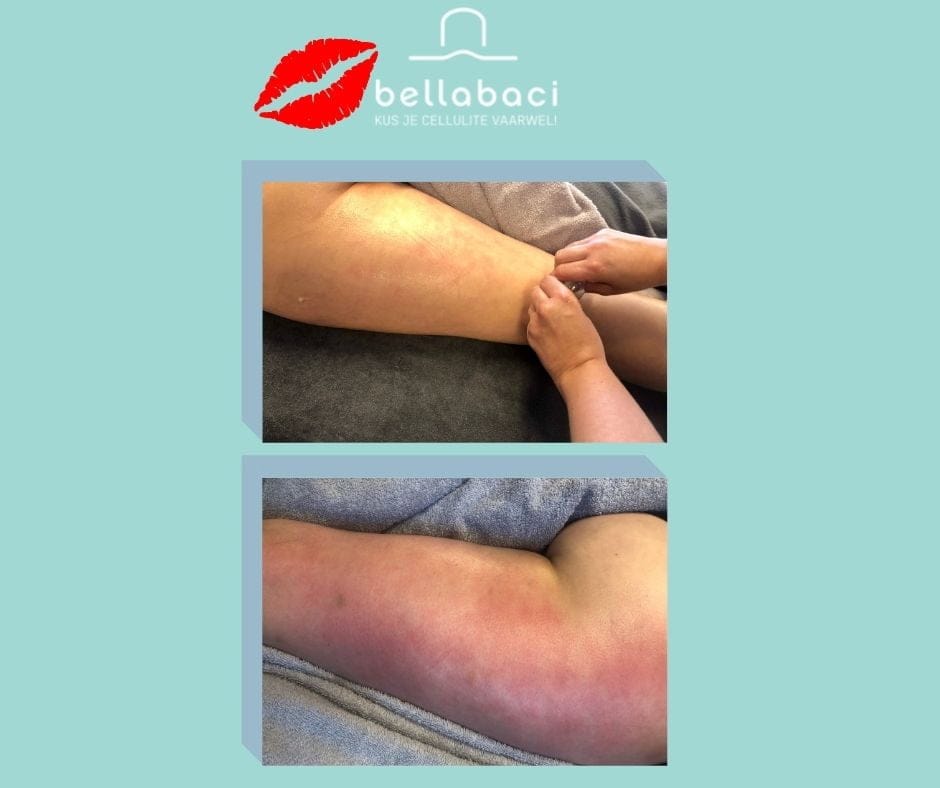 Bellabaci Benelux - Cupping